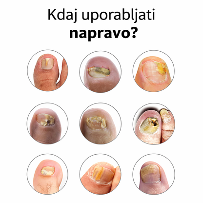 Naprava OrthoVital